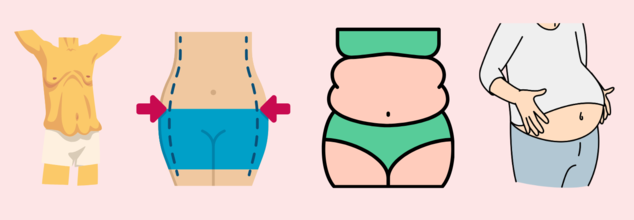 Where your body stores fat could reveal a lot about your health