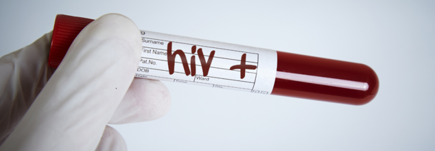 Fact Check: Can HIV Spread Through Saliva?
