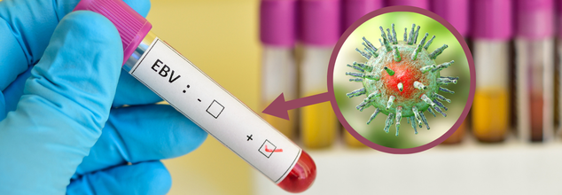 Chronic Epstein-Bar Virus: Can A Common Viral Infection Cause Fatal Brain Damage?