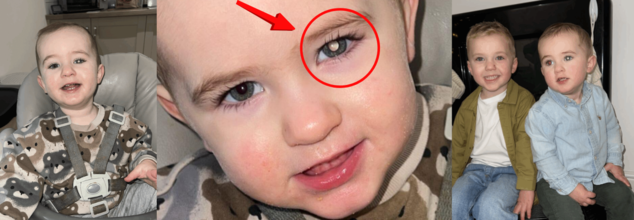 Parents Spot A Strange ‘Glow’ In Son’s Left Eye; A Googled ‘Home Test’ Confirmed Their Worst Fears