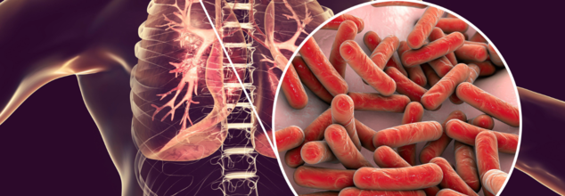 Tuberculosis detected in a Portland middle school student