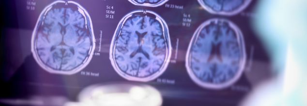 FDA Approves blood test that can diagnose alzheimer's