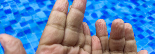 What is the science behind pruney fingers?