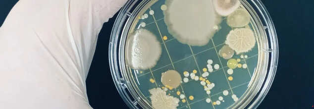 AI Tool Developed To Identify Alternative Antibiotics For Drug-Resistant Infections