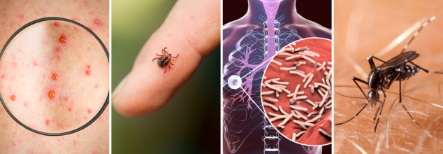 Diseases Are Spreading Fast- But Why Isn’t The CDC Saying Anything?