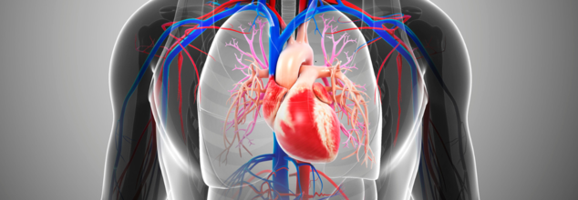 The Tendyne system for mitral annular calcification