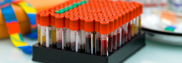 Japan Races To Develop World's First Artificial Blood