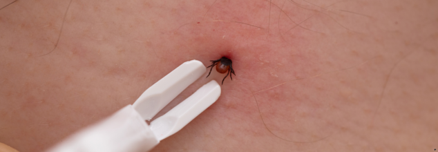 Man Dies After Tick Bite ‘Blew Up’ His Brain: What Kind Of Ticks Carry The Deadly Powassan Virus?