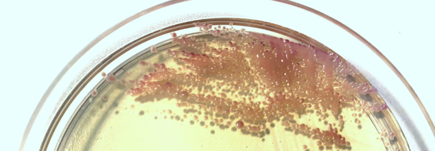 Rise in Yeast Infections in the UK