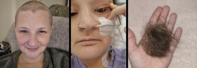 Weight-Loss Drug Ordered Online Leaves UK Woman With Hole In Esophagus