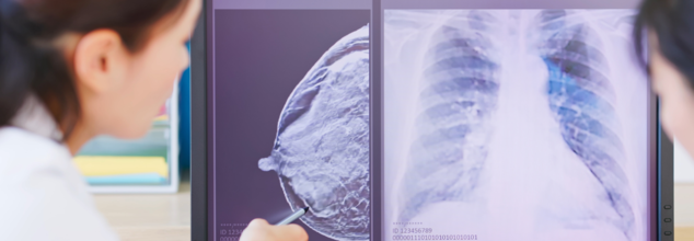 Breast Cancer Screenings For Women In 40s Could Be Life Saving
