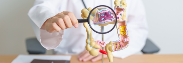 How To Recognize Symptoms And Prevent Colon Cancer?