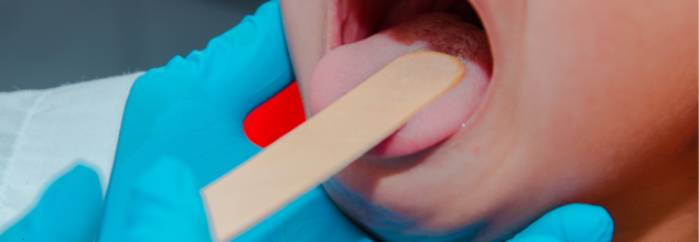 A New Study Reveals That Kids’ Tongues Show Signs of Illness