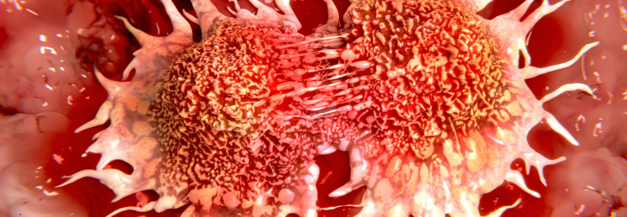 A rare cancer could be prevalent among gen x and millennials