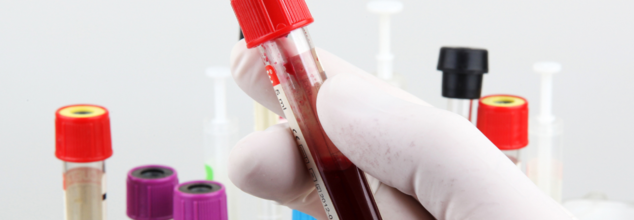 Blood Tests Could Reveal Cancer Cells 3 Years Before The Actual Diagnosis