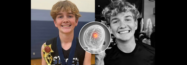 14-Year-Old Boy Dies Days After Complaining Of 'Headache And Fever' From Rare Bacterial Infection