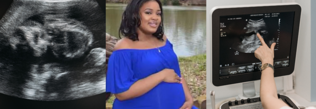 Baby born from a brain dead woman on life support in Georgia