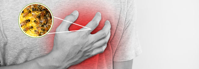 Can An Allergic Reaction Trigger Heart Attack?