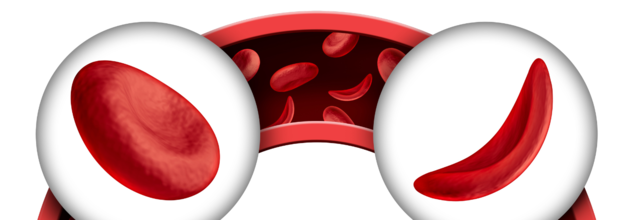 World Sickle Cell Day 2025