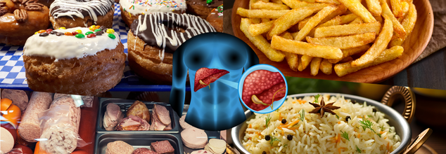 4 Foods That People With Fatty Liver Must Avoid Eating