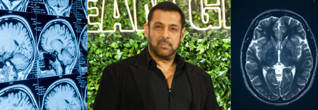 Salman Khan talks about his brain aneurism