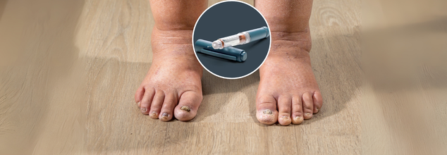 FDA Approves Once-Monthly Injection For Hereditary Angioedema; What It Means For Long-Term Treatment?