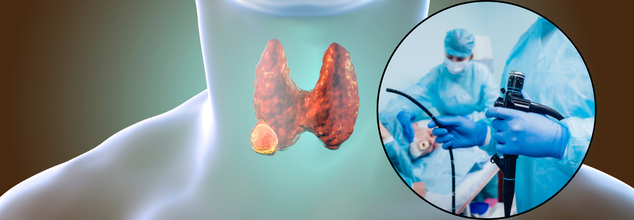 A Simple Capsule Sponge Test Can Replace Endoscopies And Make Cancer Screening Easier