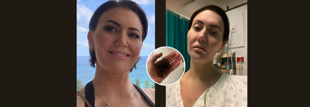 “I Thought I Was Just Tired”—Fit And Healthy Mom Diagnosed With Stage 4 Bowel Cancer After Ignoring Multiple Signs