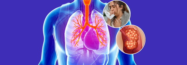 The Worst States In America For Your Lung Health, Map Reveals Areas With Highest Risk