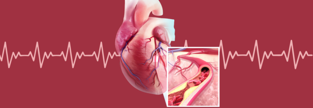 What Really Clogs Your Arteries? Tips To Keep Your Heart Healthy