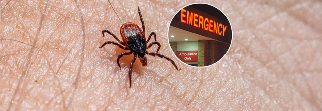 Why More Americans Are Landing In ERs Over Tick Bites This Year? Here's How To Check For Ticks