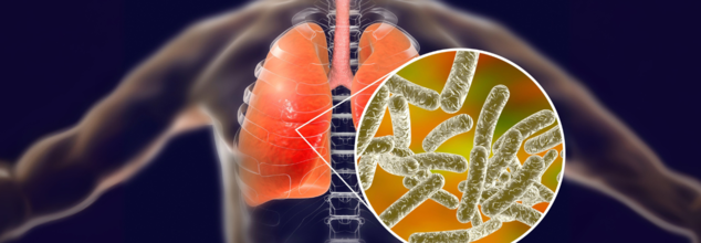 1 Dead And 40 Sick With Legionnaires Outbreak In London– What You Need To Know
