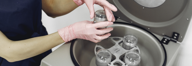 Slowing Biological Aging May Be Possible Through This Blood Therapy: Study