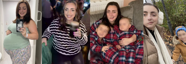 Woman Dismissed Headaches And Eye Twitch To Stress, Weeks Later Gets Diagnosed With A Tumor That Left Her Face Paralyzed