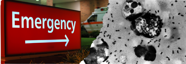 Arizona Resident Dies Of Bubonic Plague Only 24 Hours After Showing Symptoms, All About The Rare Case