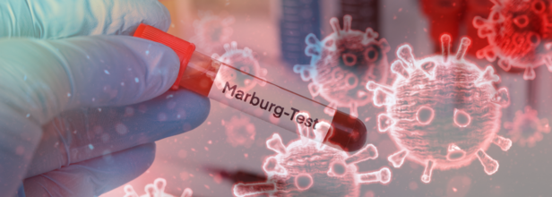 The Marburg Virus Is Back In Focus Thanks To A Ugandan Scientist, Here's What We Know So Far
