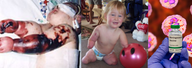 Australia Sees Rise In Meningococcal Disease: What You Need To Know About Symptoms And Vaccination