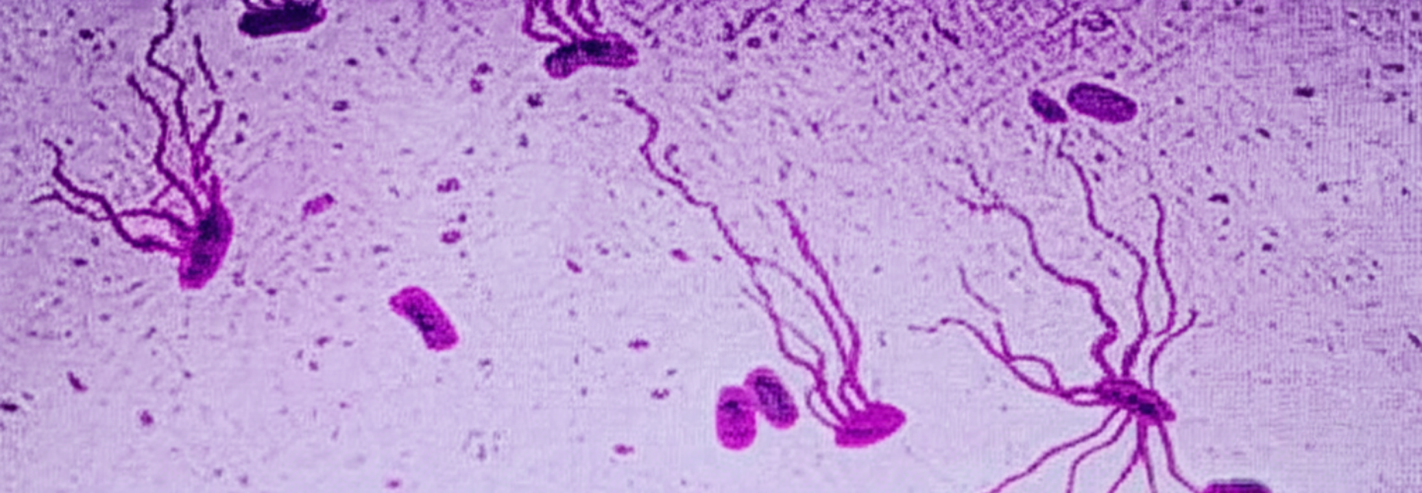 Super Typhoid: This Age-Old Killer Is Spreading Fast and Isn't Just a ...