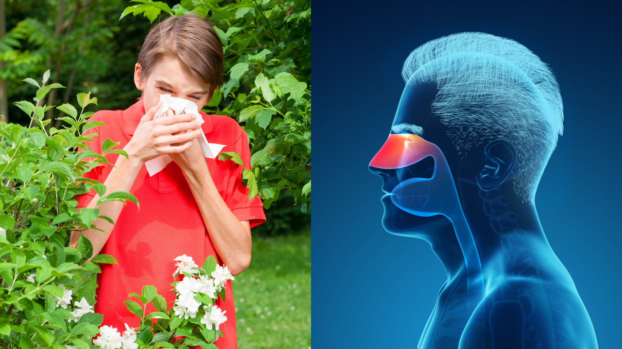 Think It Is Just a Cold? It Could Be Allergic Rhinitis, and Here is Why ...