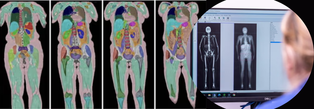 UK Scientists Scan Over 100,000 People, What The Human Imaging Study Could Reveal About Your Health?