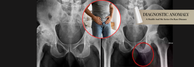 Diagnostic Anomaly: Rare Condition Turned Man’s Penis 'Rock Hard' Into Bone