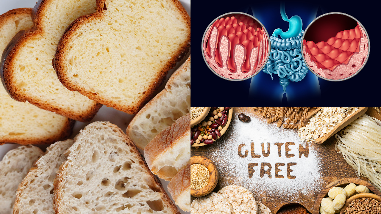 What is Coeliac Disease That Affects 2 Million People in the U.S. Each ...