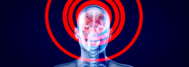 World Brain Day 2025: Signs of Brain Tumors You Might Be Dismissing as “Just Stress”