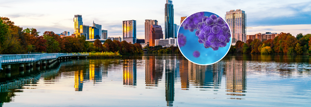 Contagious Measles Virus Found In Austin Wastewater; How Water Could Accelerate The Outbreak?