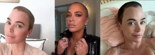 Teddi Mellencamp Health Update: Immunotherapy For Skin Cancer On Hold, Tumors In Lungs And Brain Also Shrink