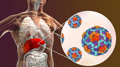 Hepatitis Day 2025: Is Hepatitis On A Decline Or Still A Cause Of Concern?