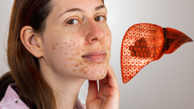 ‘Don’t Ignore That Itch’: 4 Skin Clues Linked To Liver Disease, Warns Harvard Doctor