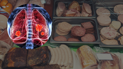 Not Just Cigarettes, But You Food Too Could Increase Your Chance Of Lung Cancer