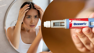 Not Just Face, 'Ozempic Hair' Is The Latest Side Effect Everyone’s Talking About