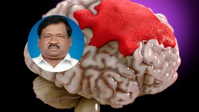 Jharkhand Education Minister Ramdas Soren Suffers Brain Hemorrhage, Airlifted To Delhi